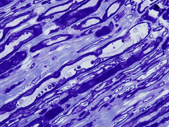 1A9 AMAN (Case 1) Plastic 7.jpg