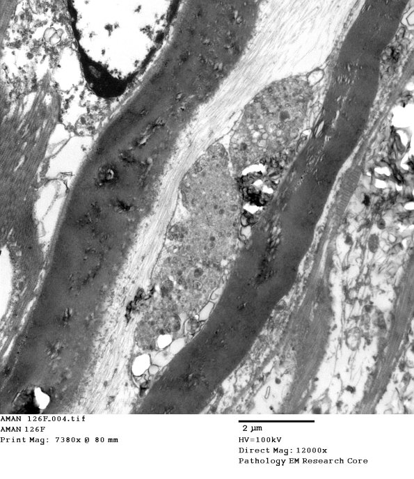 1B AMAN  (Case 1) - Copy