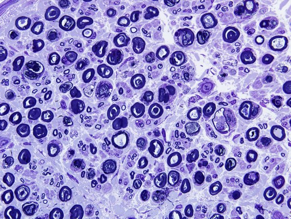 2A2 AMAN (Case 2) Plastic 17.jpg