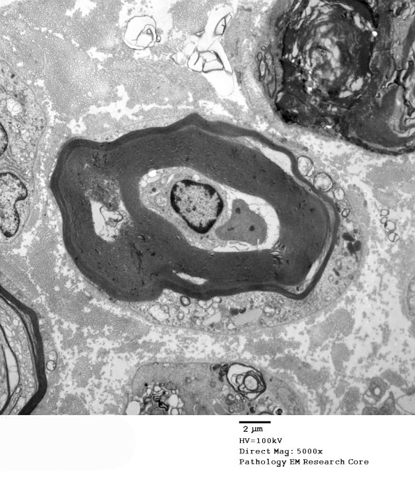 2B2 AMAN (Case 2)_002A - Copy