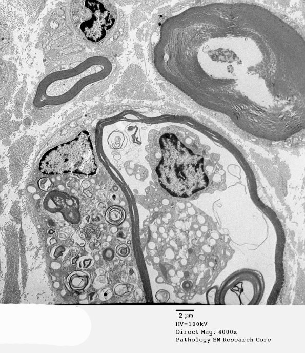 2B4 AMAN (Case 2)_016A - Copy