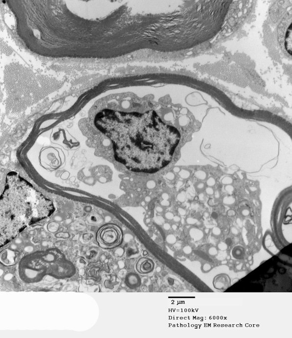 2B5 AMAN (Case 2)_017A - Copy