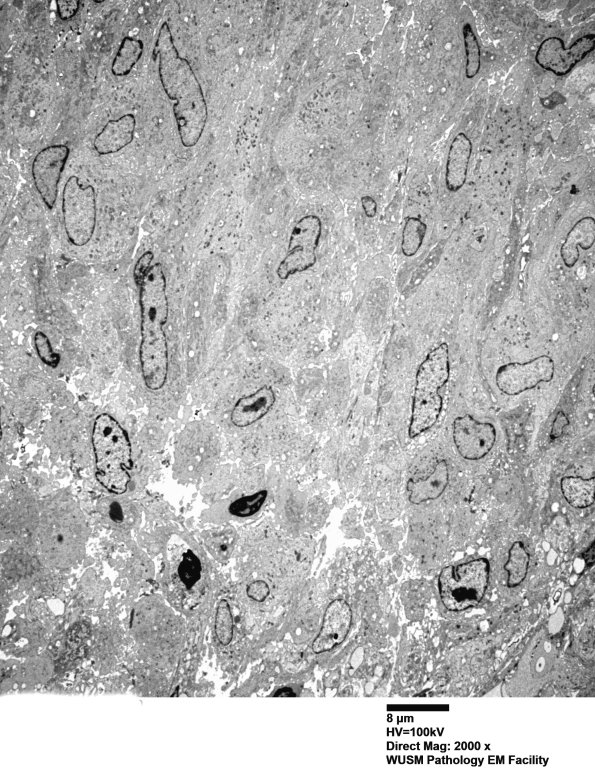 1F1 (Case 1)_019 - Copy