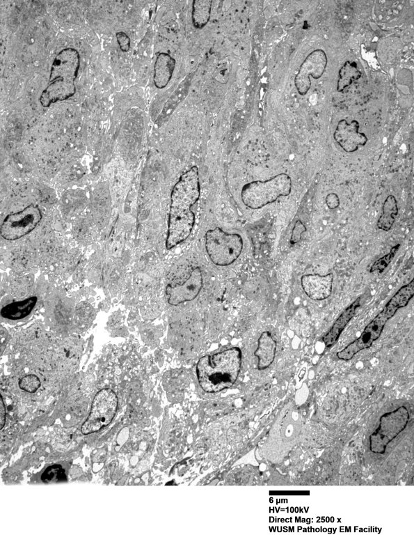 1F2 (Case 1)_010 - Copy