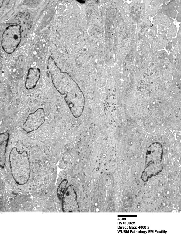 1F3 (Case 1)_013 - Copy