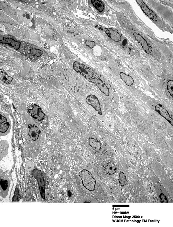 1F4 (Case 1)_002 - Copy