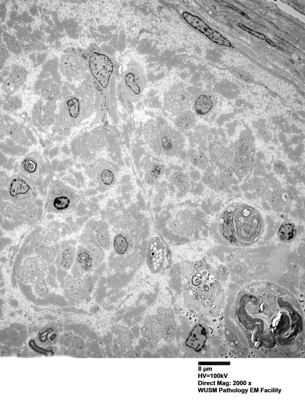 1G1A (Case 1)_023 - Copy