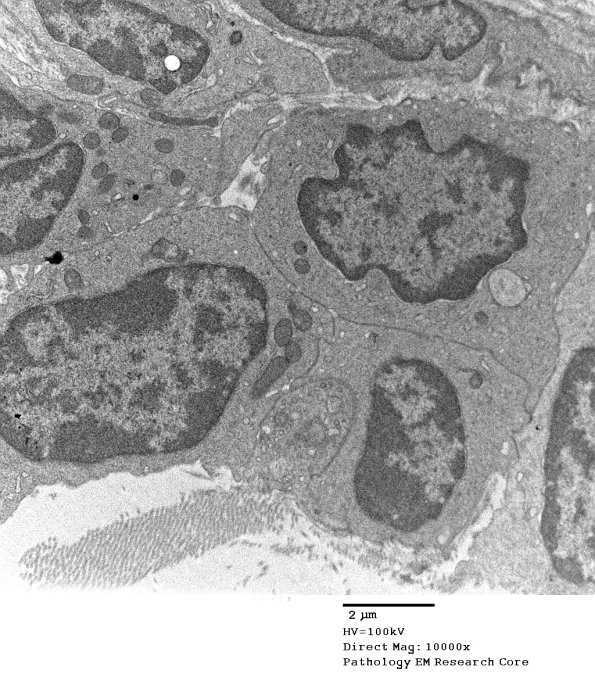 2E1 (Case 2) Nerve_136 - Copy