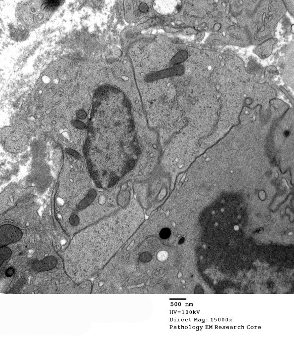 2E2 (Case 2) Nerve_083 - Copy