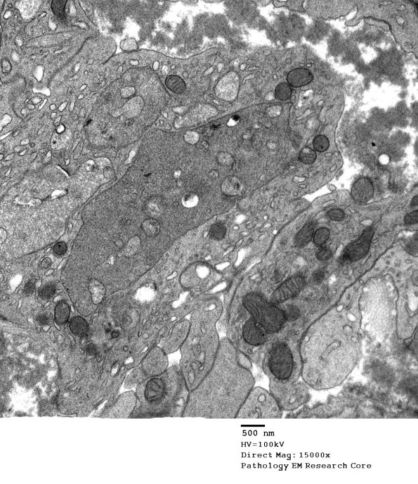 2E3 (Case 2) Nerve_084 - Copy