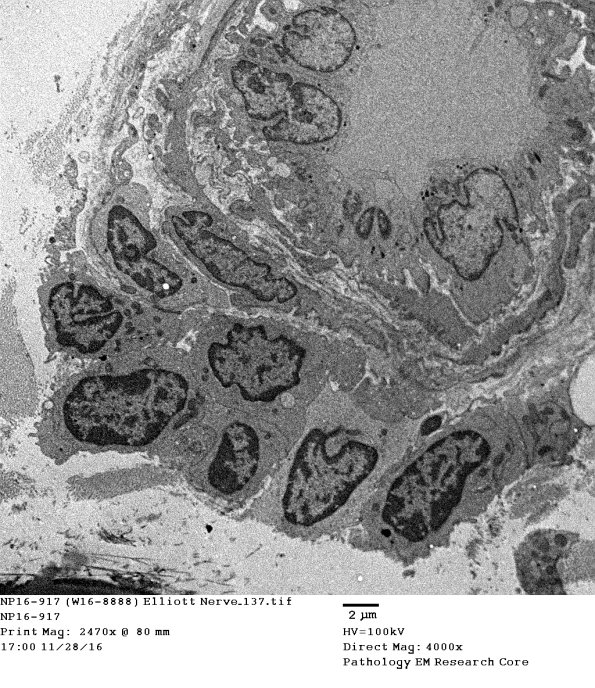 2E9 (Case 2) Nerve_137 - Copy