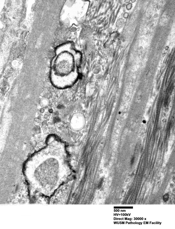 13A3 (Case 13) Nerve_003 - Copy