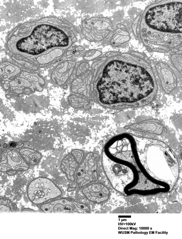 2C1 W20-8226A  (Case 2) EM 034 - Copy