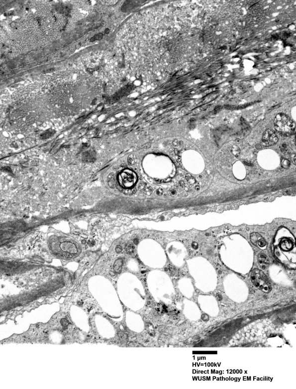 2D1 W20-8226A  (Case 2) EM 030 - Copy