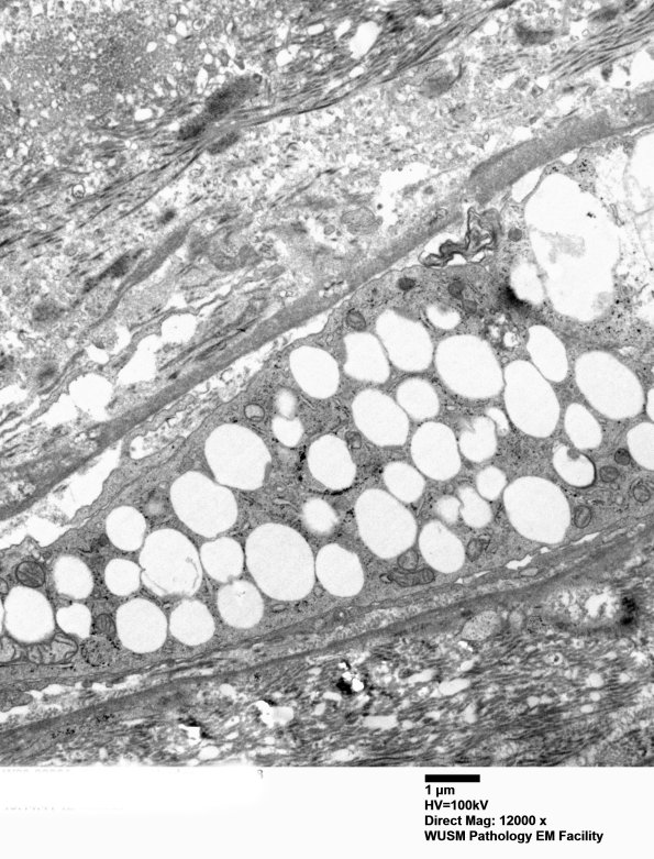 2D2 W20-8226A  (Case 2) EM 028 - Copy