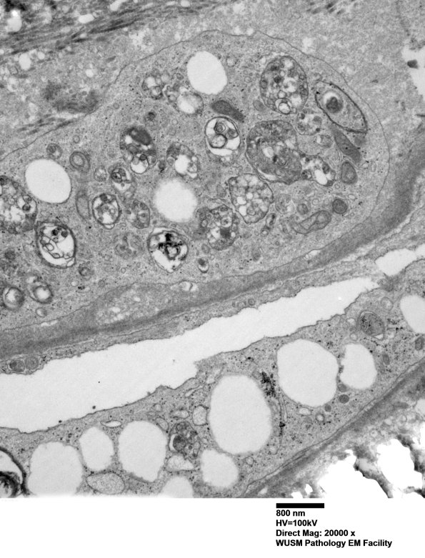 2D3 W20-8226A  (Case 2) EM 031 - Copy