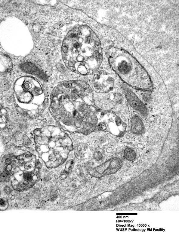 2D4 W20-8226A  (Case 2) EM 032 - Copy