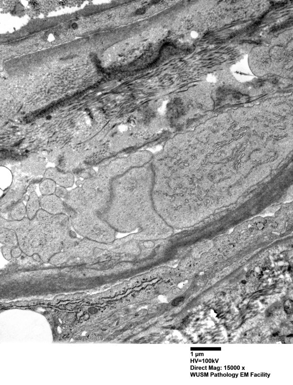 2D5 W20-8226A  (Case 2) EM 033 - Copy