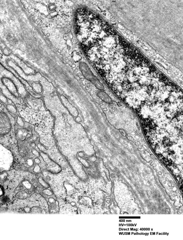 2D6 W20-8226A  (Case 2) EM 070 - Copy