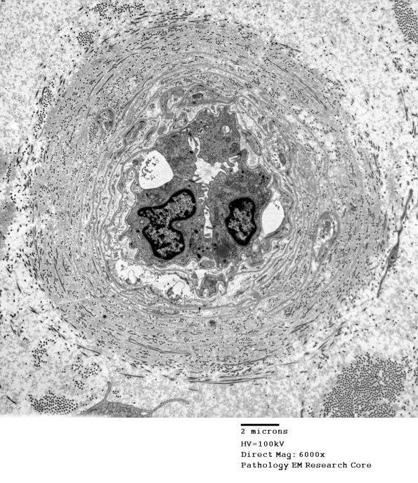 8A1 (Case 8) 002 - Copy