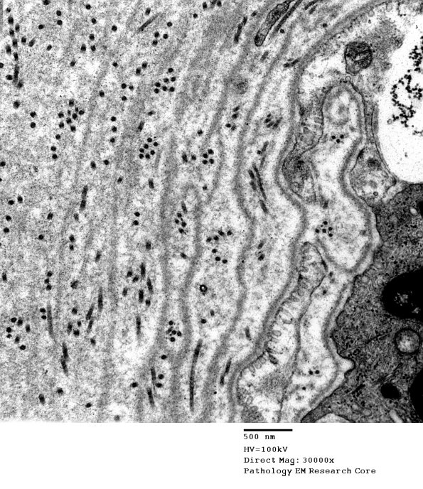8A2 (Case 8) 004 - Copy