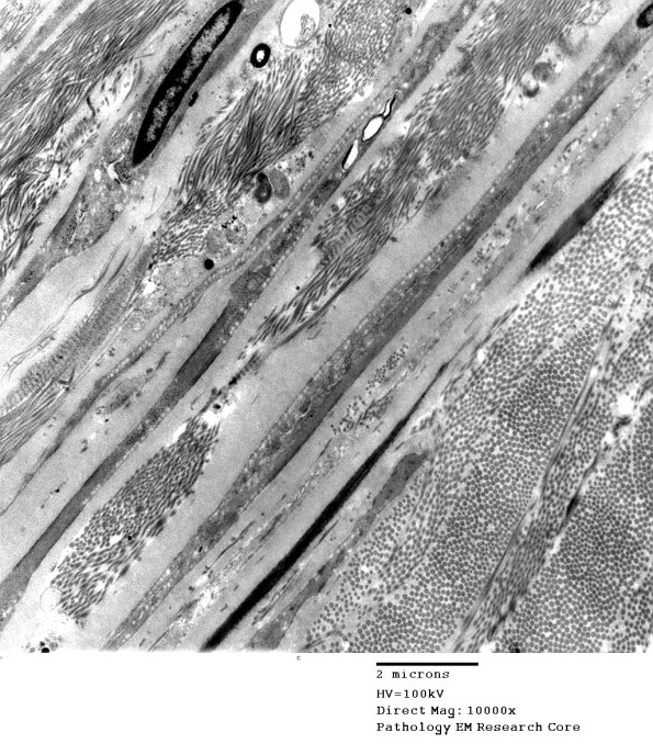 8A3 (Case 8) 012A - Copy