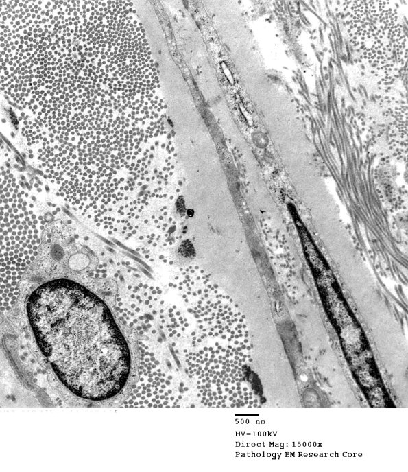 8A4 (Case 8) 007 - Copy