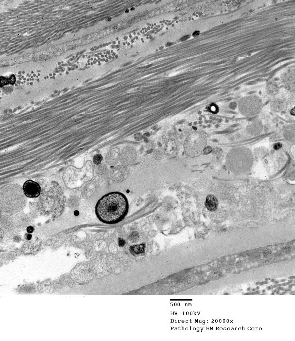 8A6 (Case 8) 026 - Copy