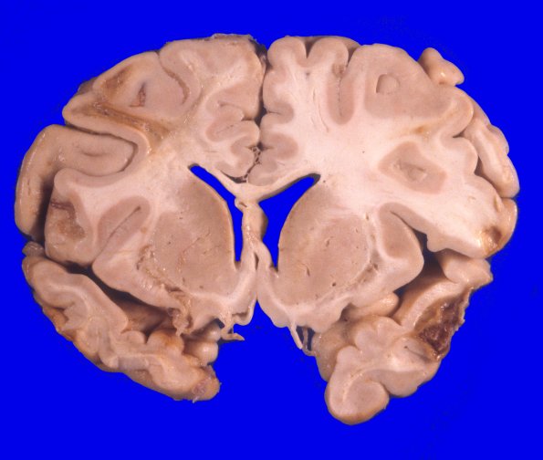 17A6 Trauma, Baseball bat (Case 17) 5