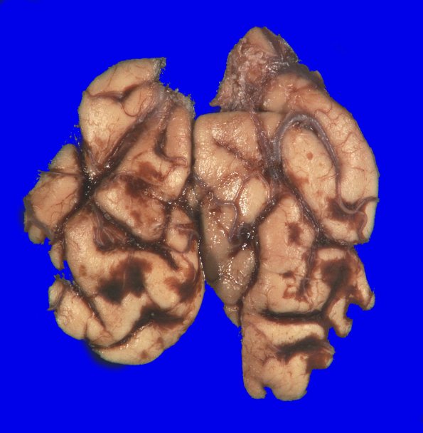2A7 Trauma, contusion,  (Case 2) _6