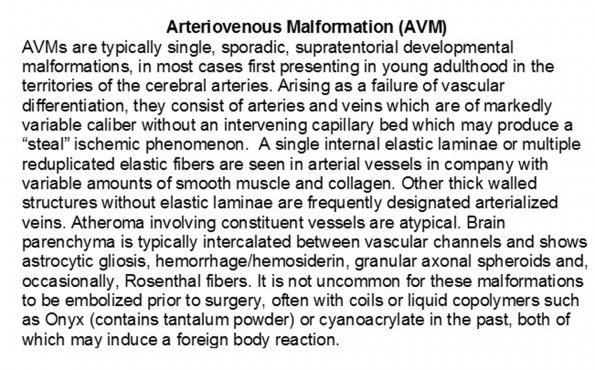 0A Arteriovenous Malformations (AVM) - Text