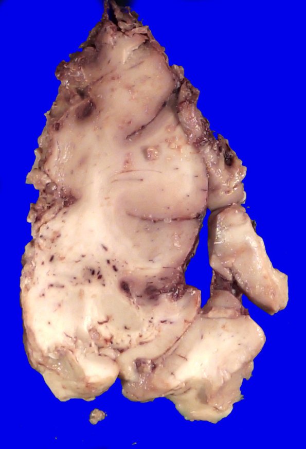 36B1 Case 36.A.038