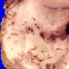 36B2 Case 36.A.037