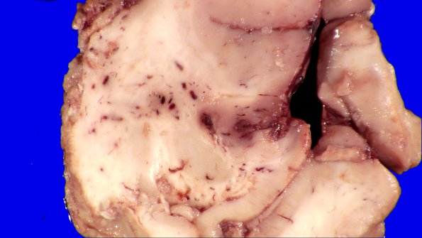 36B2 Case 36.A.037