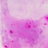 36C1 Case 36 A9 H&E WM