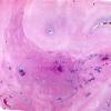 36D1 Case 36 A9 TRI WM