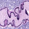 36E6 AVM (Case 36) A9 VVG 20X 2