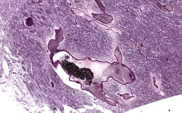 36E8 AVM (Case 36) A9 VVG 4X 21