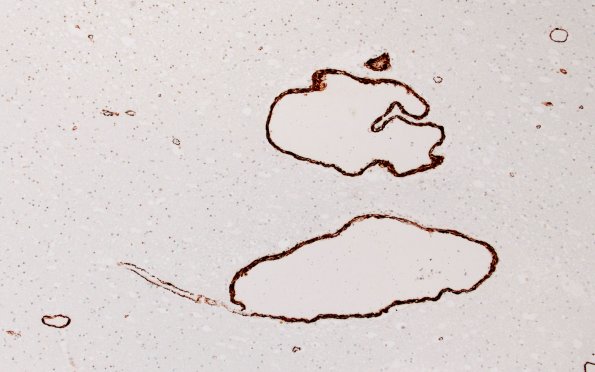 36F4A AVM (Case 36) A9 SMA 10X 2