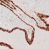 36F5B AVM (Case 36) A9 SMA 20X 4