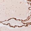 36F7 AVM (Case 36) A9 SMA 20X 1
