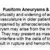 0A Aneurysms - Fusiform