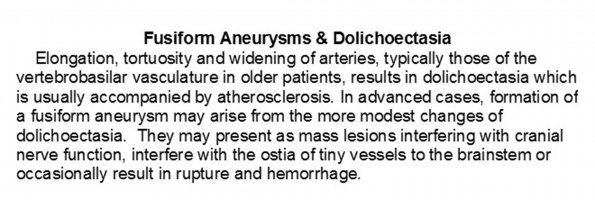 0A Aneurysms - Fusiform