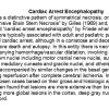 0A Cardiac Arrest Encephalopathy - Text