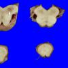 7A3 Hypoxia, 2 wk after CPA (Case 7) _9 copy