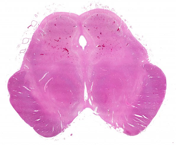 7B1 Hypoxia, 2 wk after CPA (Case 7) R9 whole mount