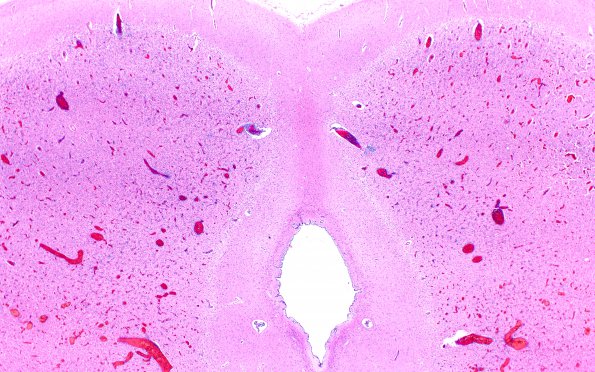 7B2 Hypoxia, 2 wk after CPA (Case 7)) R9 H&E 2X