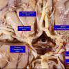 1A5 Circle of Willis (Case 1) 4