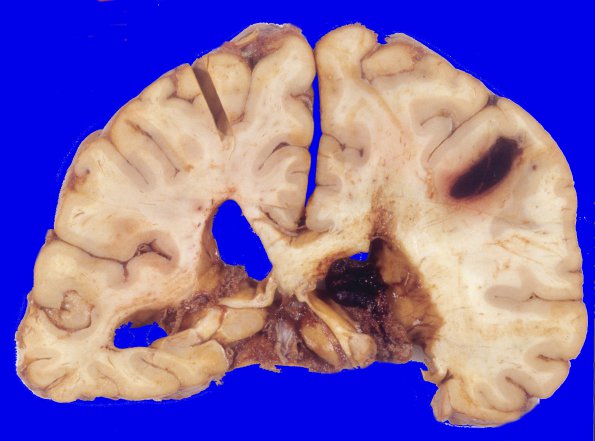 24A1 CAA & AD (Case 24) 7