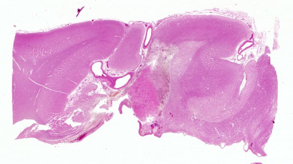 24B1 CAA & AD (Case 24) 1 WM